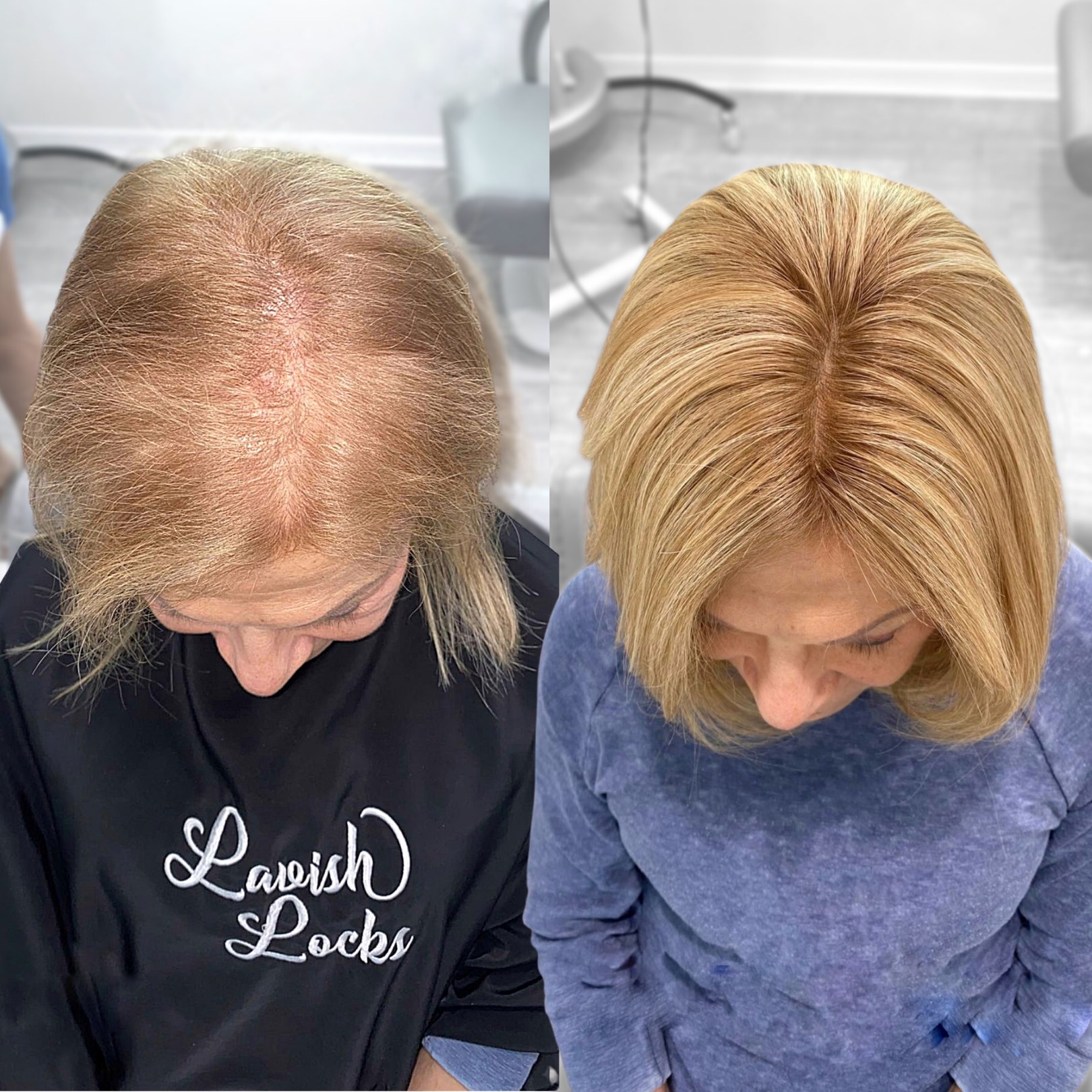 Lavish Locks integrated hair replacement topper